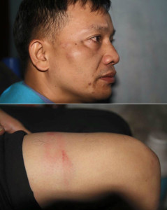 Ls. Nguyễn Văn Đài bị hành hung