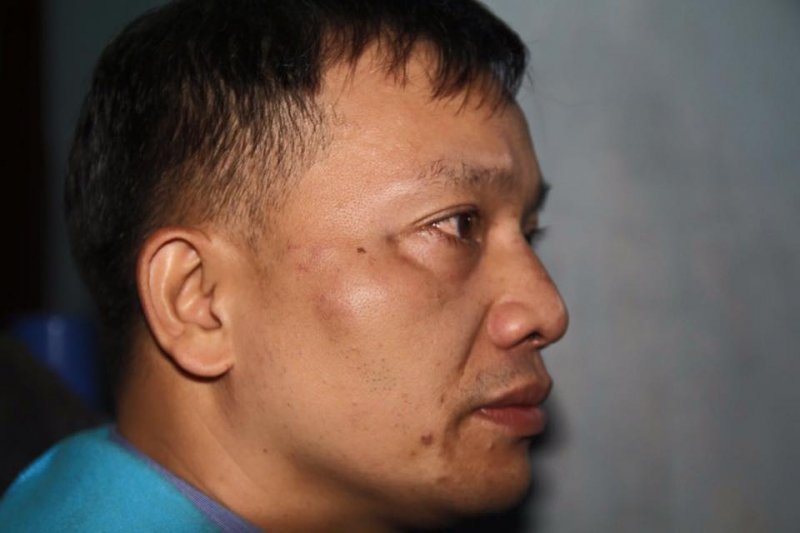 Luật sư Nguyễn Văn Đài bị đánh đập bởi công an mặc thường phục tại Nghệ An ngày 6-12-2015. Ông bị bắt giam 10 ngày sau đó.