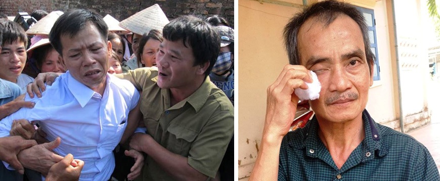 Ông Nguyễn Thanh Chấn (trái) được trả tự do sau gần 10 năm thụ án tù oan. Ông Huỳnh Văn Nén còn được biết đến với tên gọi "Người tù thế kỷ" được thả sau 17 năm tù vì án oan.