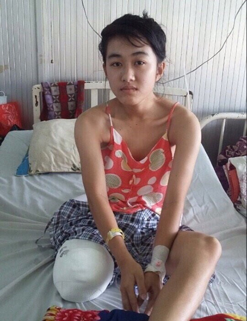 Nữ sinh Lê Thị Hà Vi bị cưa chân vì bác sĩ tắc trách. Ảnh: zing.vn