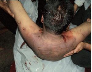 Hình một người bị tra tấn đánh đập ở đồn công an. Ảnh đăng trên facebook Thùy Trang Nguyễn 
